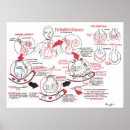 Recherche de anatomie poumon art Alvéoles