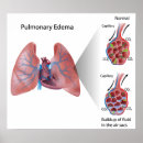 Recherche de pulmonaire posters Hypertension