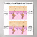 Recherche de dermatologie posters Soins