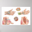 Recherche de artère posters Détail