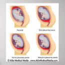 Recherche de gynécologie posters Obgyne