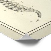  1831 Spinale kolomanatomie Afdrukken Poster (Hoek)