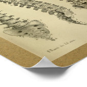 1850  anatomie Afdrukken Humaan ruggengraat Poster (Hoek)