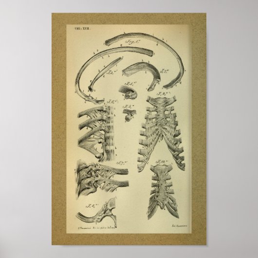 1850  Anatomy Print Rib Cage (Voorkant)
