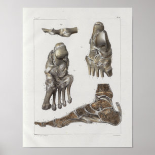 1867 Foot Botten Anatomy Print