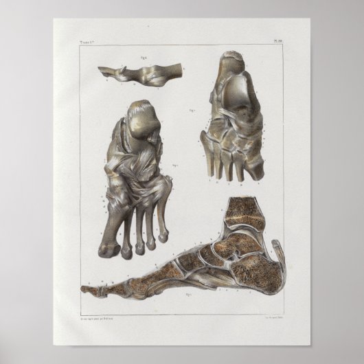 1867 Foot Botten  Anatomy Print (Voorkant)