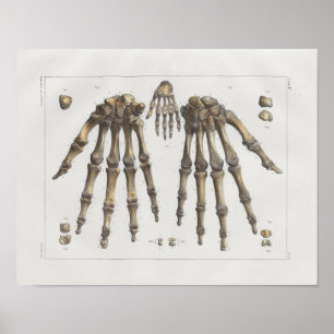 1867 Hand Wrist Botten  Anatomy Print