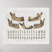 1867 Jaw Teeth Dental Anatomy Print (Voorkant)