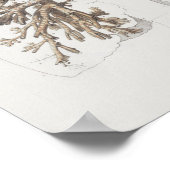 1867 Lungs Bronchi  Anatomy Print (Hoek)