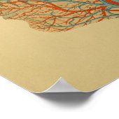 1879 anatomie Afdrukkoparteriën Veins Poster (Hoek)