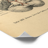  1888 Duits Anatomy Print Brain (Hoek)