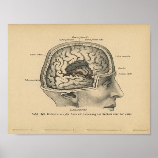  1888 Duits Anatomy Print Skull Brain (Voorkant)