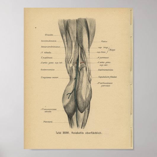  1888 Duitse Anatomy Print Beenknie (Voorkant)