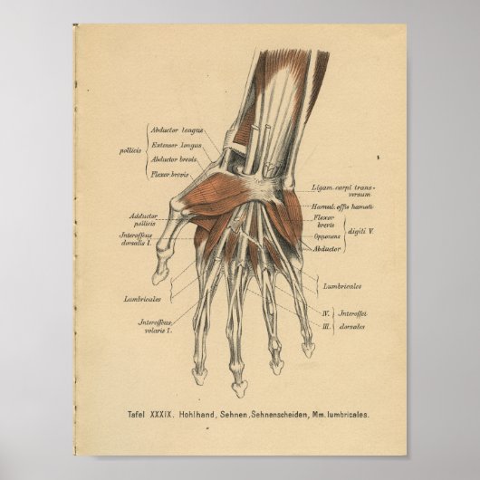 1888 Duitse Anatomy Print Hand Wrist (Voorkant)