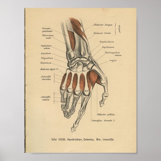 1888 Duitse Anatomy Print Hand Wrist (Voorkant)