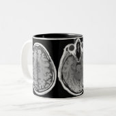 2 Couleurs Tasse d'image de cerveau d'IRM (Devant gauche)