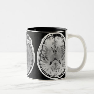 2 Couleurs Tasse d'image de cerveau d'IRM