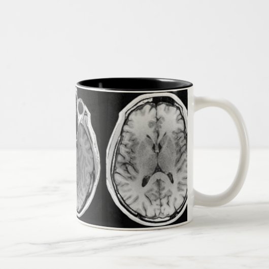 2 Couleurs Tasse d'image de cerveau d'IRM (Droit)