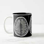 2 Couleurs Tasse d'image de cerveau d'IRM (Gauche)