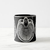 2 Couleurs Tasse d'image de cerveau d'IRM (Centre)