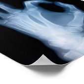 A-OK X-RAY POSTER (Hoek)