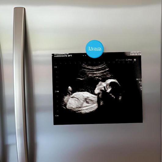Aangepaste Azure Blue Name Ultrasound Display Koel Magneet