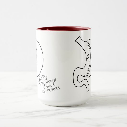 Aangepaste datum van Sleeve in de maag Mok (Midden)