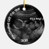 Aangepaste EASY Ultrasound Sjabloon Keramisch Ornament (Achterkant)