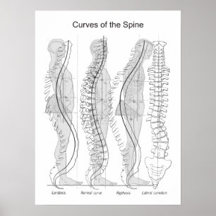 Abnormal Curves of the Spine Poster Chiropractic