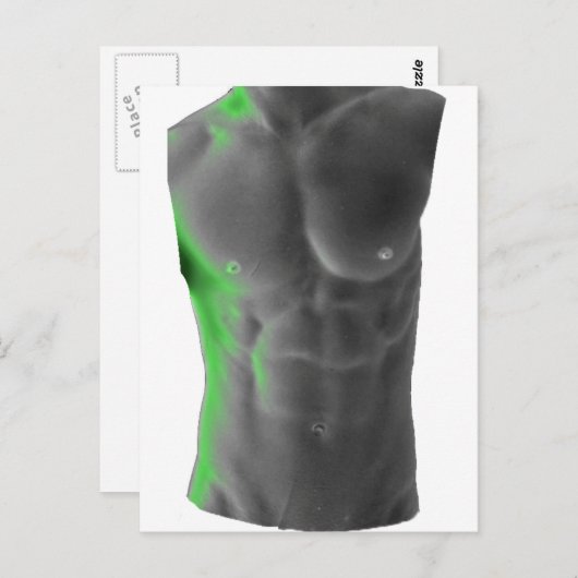 Abs Briefkaart (Voorkant / Achterkant)