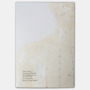 Acupunctietest vervaagt post-it® notes