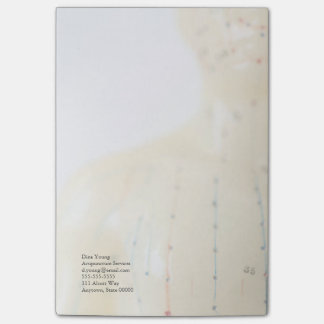 Acupunctietest vervaagt post-it® notes