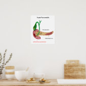 Acuut Pancreatitis Poster (Keuken)