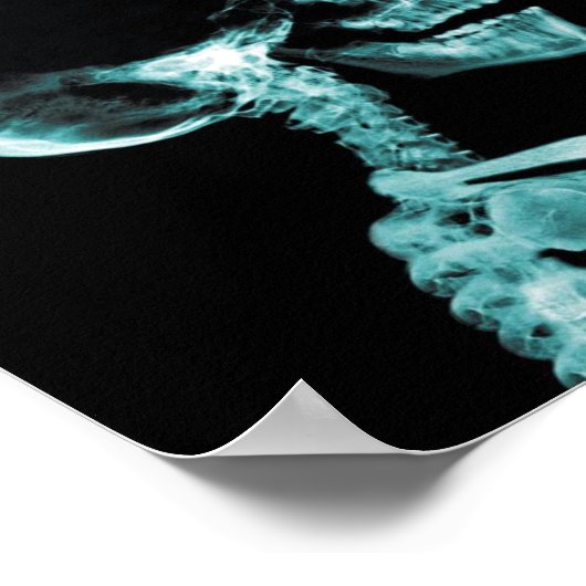 affiche à rayons X (Coin)