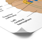 Affiche de la voie de projection visuelle (Coin)