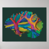 Affiche du cerveau de la forêt (Devant)