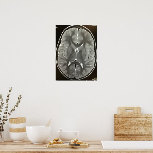 Affiche du cerveau IRM (Cuisine)