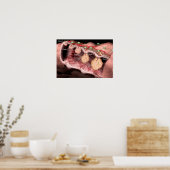 Affiche sur le cancer du côlon (Cuisine)