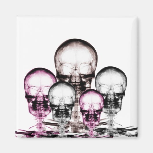 Aimant Couleurs mixtes Skeletons de vision à rayons X (Devant)