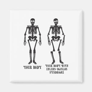 Aimant Ehlers - Votre Corps Avec Ehlers Syndrome Danlos A
