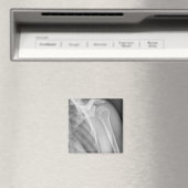 Aimant épaule normale. Rayon X de la gauche en santé (In Situ (Lave-vaisselle))