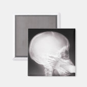 Aimant Foot à Mouth X-Ray (Recto/Verso)