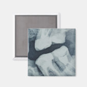 Aimant Gros plan d'une radiographie dentaire (Recto/Verso)