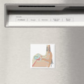 Aimant Implants cochléaires (In Situ (Lave-vaisselle))