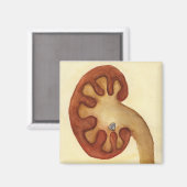 Aimant pierre rénale (Recto/Verso)