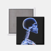 Aimant Rayon X des os dans le cou (Recto/Verso)