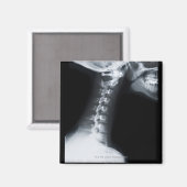 Aimant Rayon X des vertèbres du cou, y compris la mâchoir (Recto/Verso)