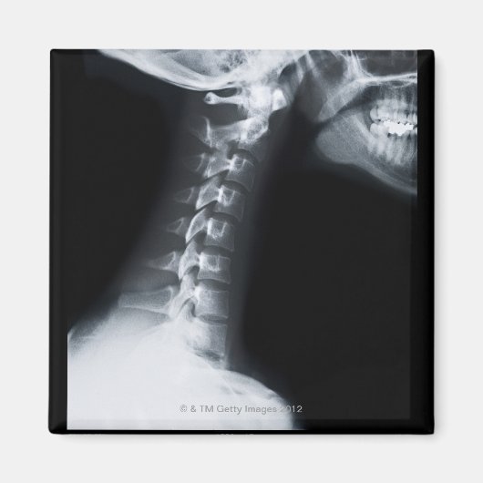 Aimant Rayon X des vertèbres du cou, y compris la mâchoir (Devant)