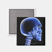 Aimant Rayon X rapproché des os du cou (Recto/Verso)