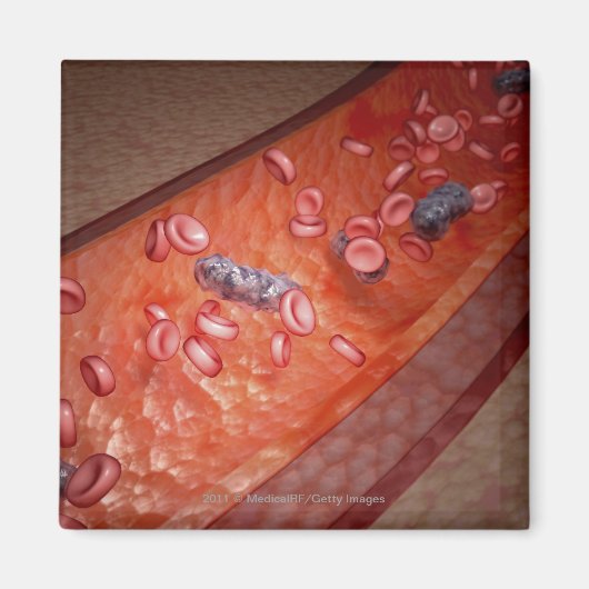Aimant Rendu microscopique d'une infection sanguine (Devant)